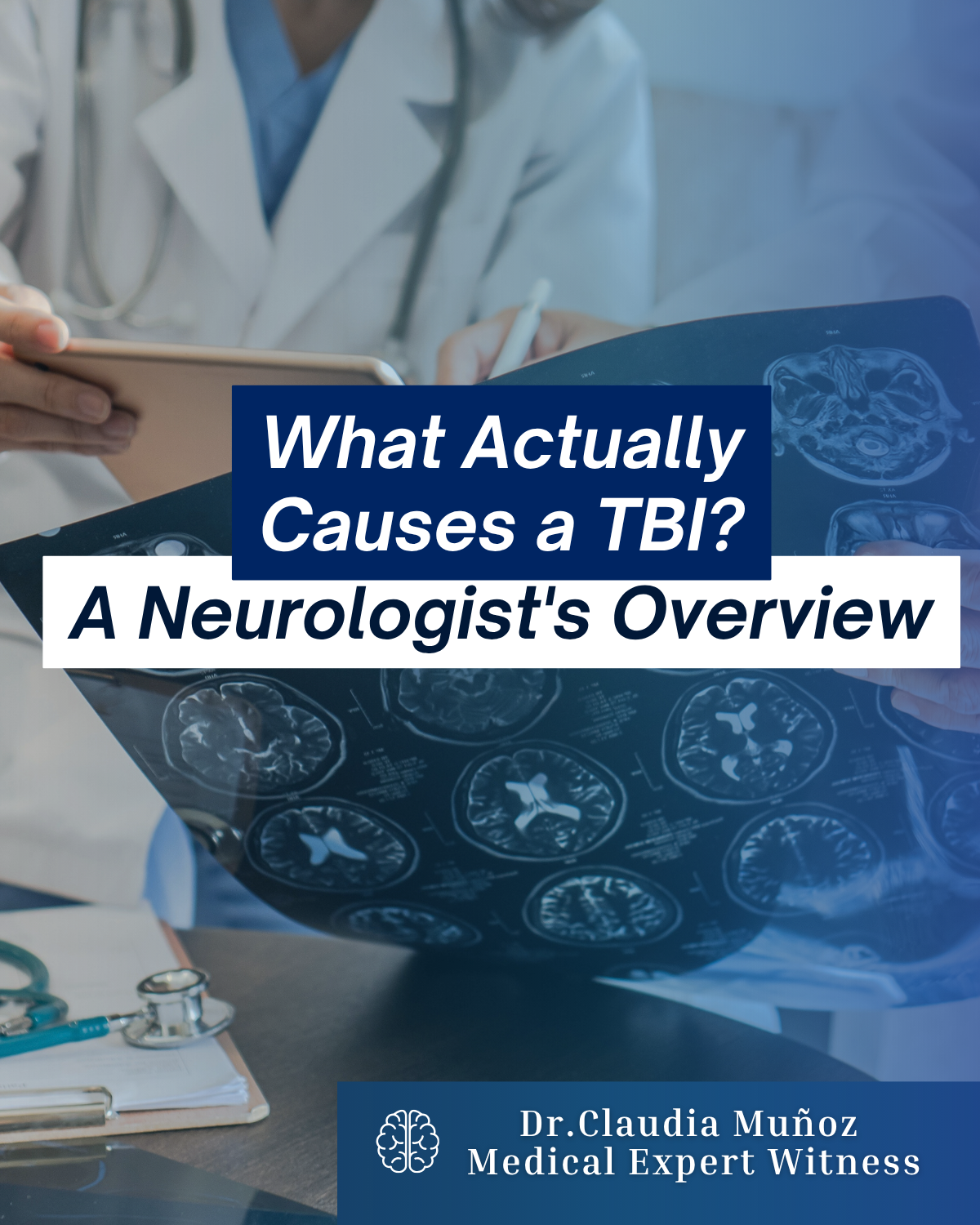What Actually Causes a TBI? A Neurologist's Overview