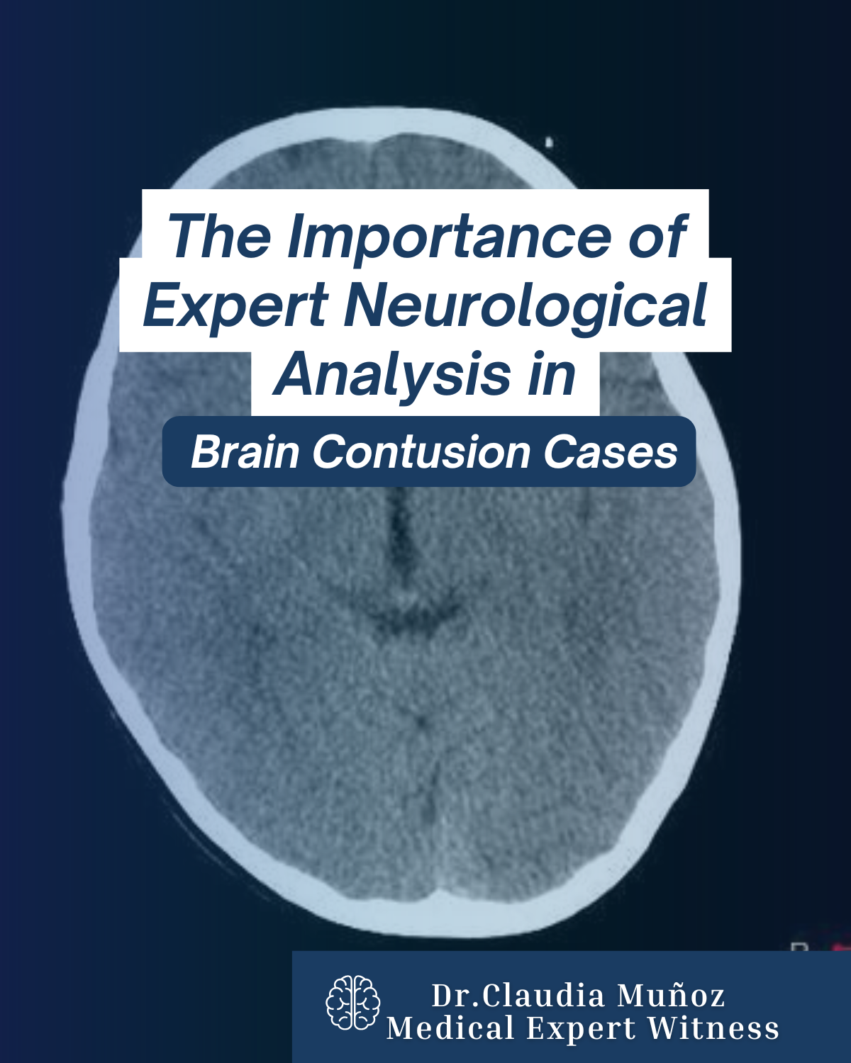 f Expert Neurological Analysis in Brain Contusion Cases