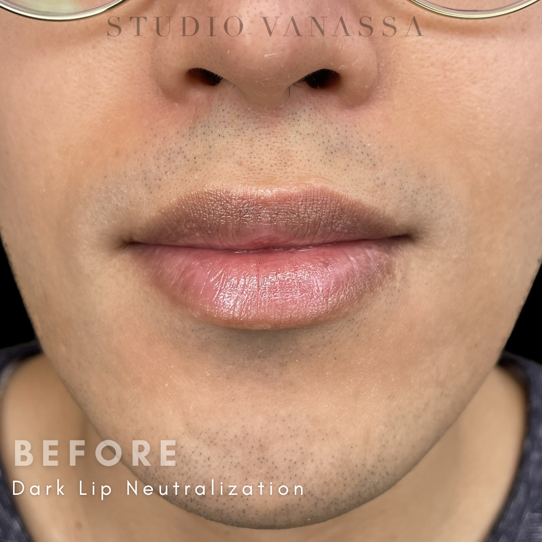 Best Male Lip Blush and Neutralization in Edmonton, Alberta at Studio Vanassa on Whyte Ave