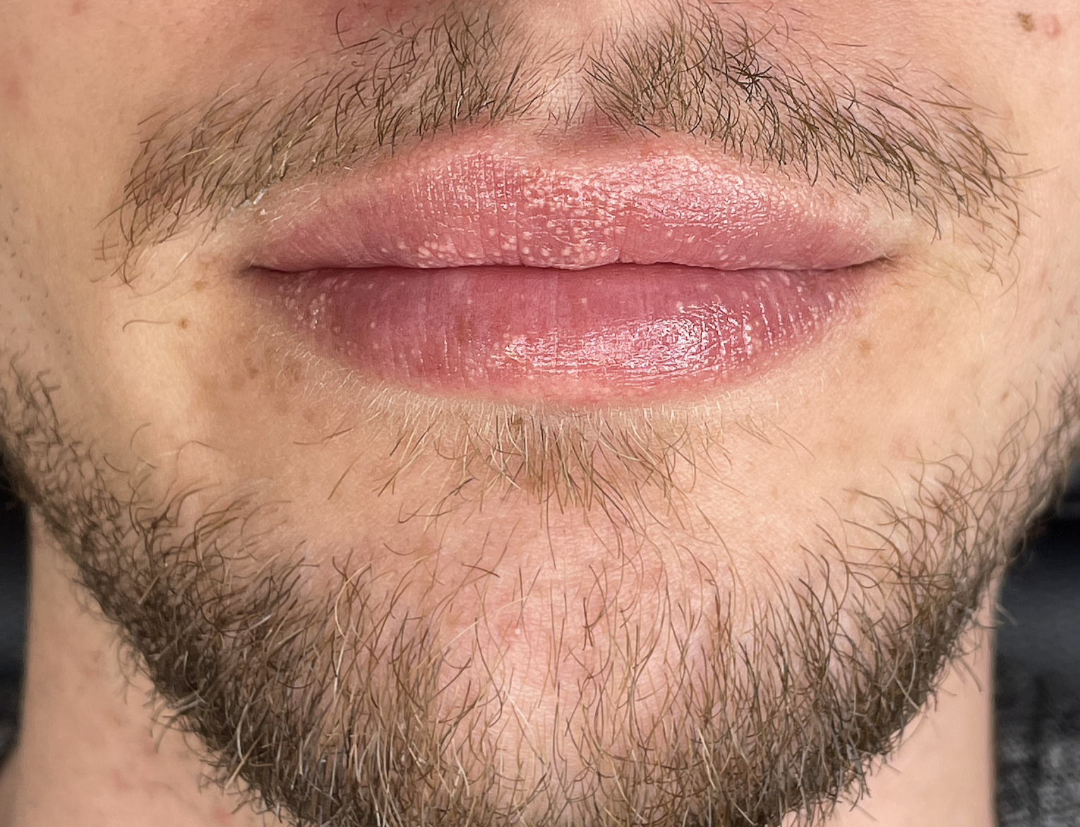 Best Male Lip Blush and Neutralization in Edmonton, Alberta at Studio Vanassa on Whyte Ave