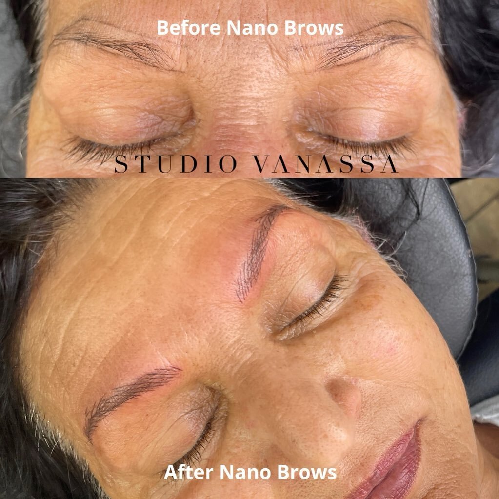 THREE REASONS WHY NANO BROWS HEAL PERFECTLY: 
🗝 No bleeding
🗝 Less trauma to the skin
🗝 Little to no scabbing
= Better healed results

Why less scabbing?
Using a machine and a single point needle we implant the pigment into the skin similar how a 
