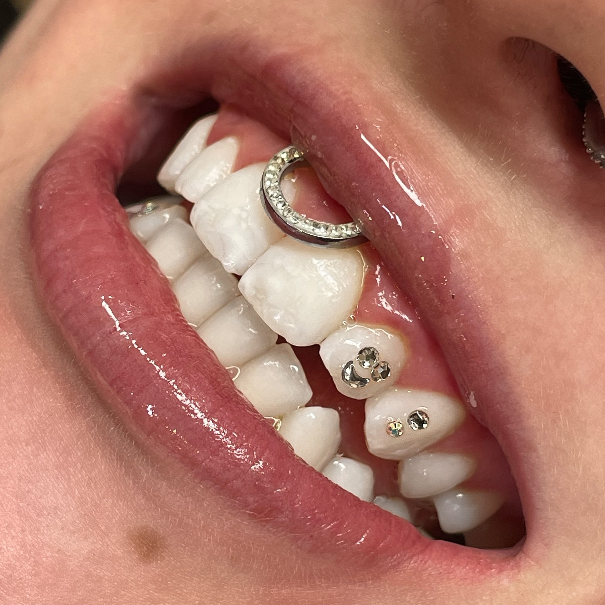 Tooth gems! 😃

😃 Crystal clear smiley face
💕 Iridescent stack
✨ Iridescent lower tooth 

📓TO BOOK WITH VANASSA :
Send a or www.studiovanassa.com

📍Studio Vanassa
💌 vanassa@studiovanassa.com
💻 www.studiovanassa.com 
📞 780-297-8030

#edmonton #