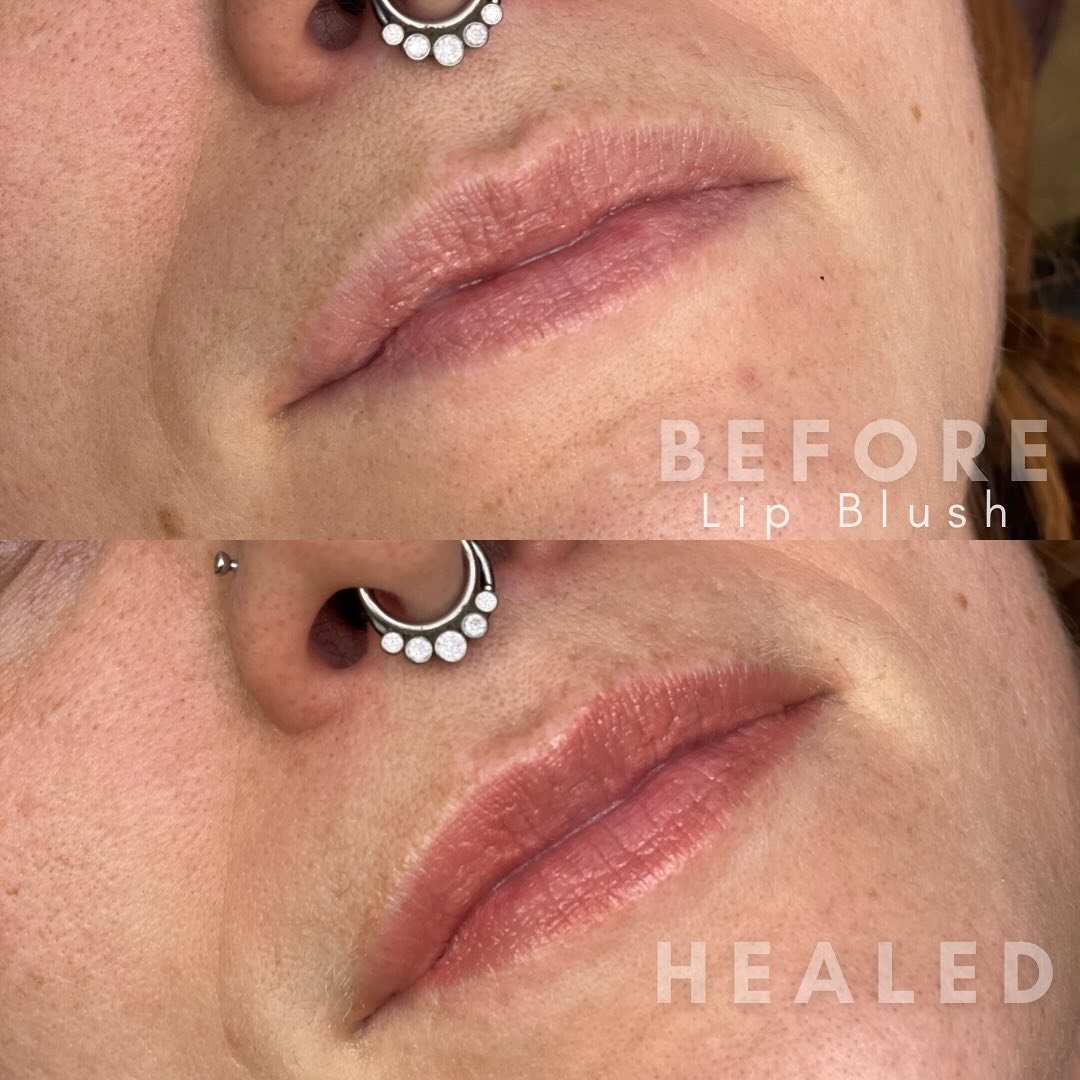 Her Lips but Better 💕

My client came in with concerns about her fordyce spots. 
We camouflaged her Fordyce spots with a natural lip tint to bring her lips back to life! 
Can you see the white spots in her before picture? 

📓TO BOOK WITH VANASSA :
