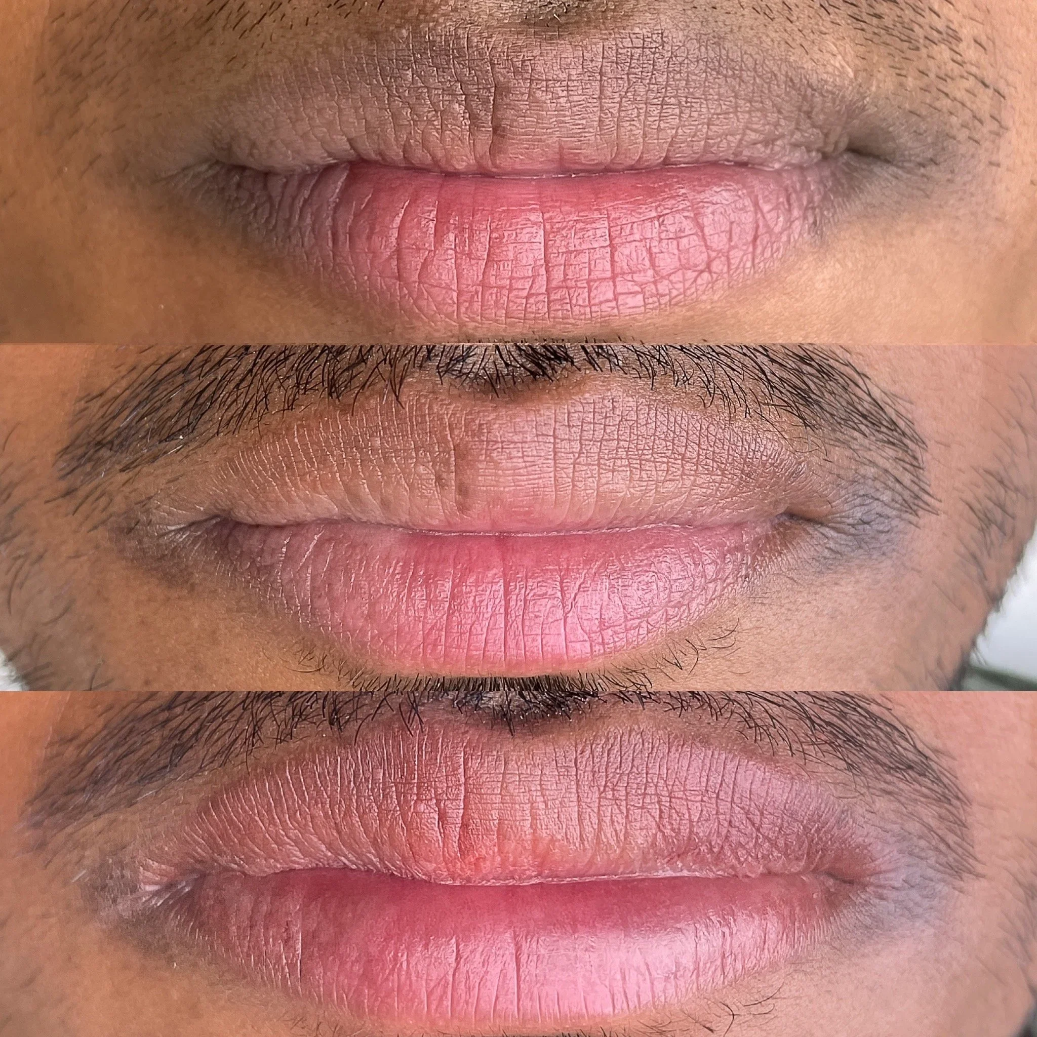 Before, during healing, and healed results of lip blushing for men