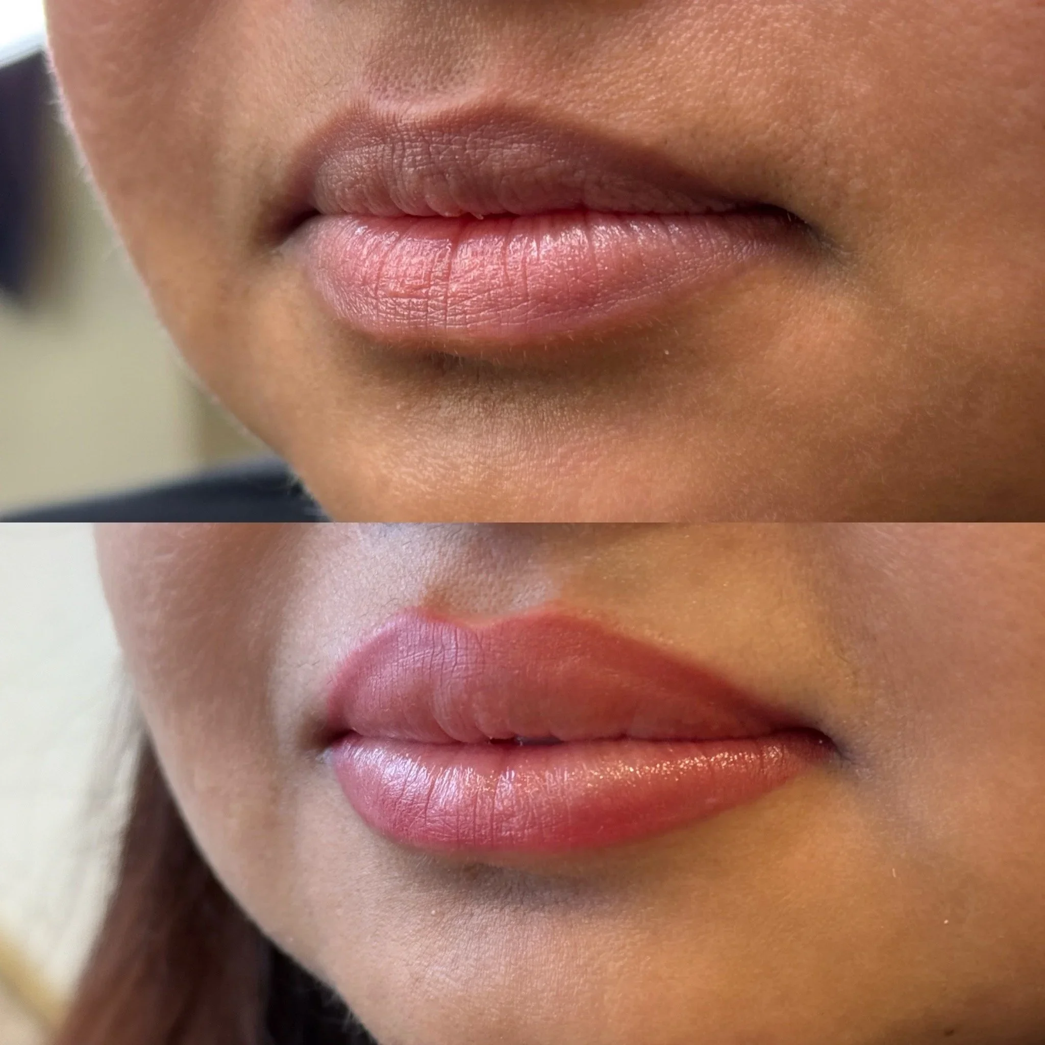Lip neutralization results for brighter lips