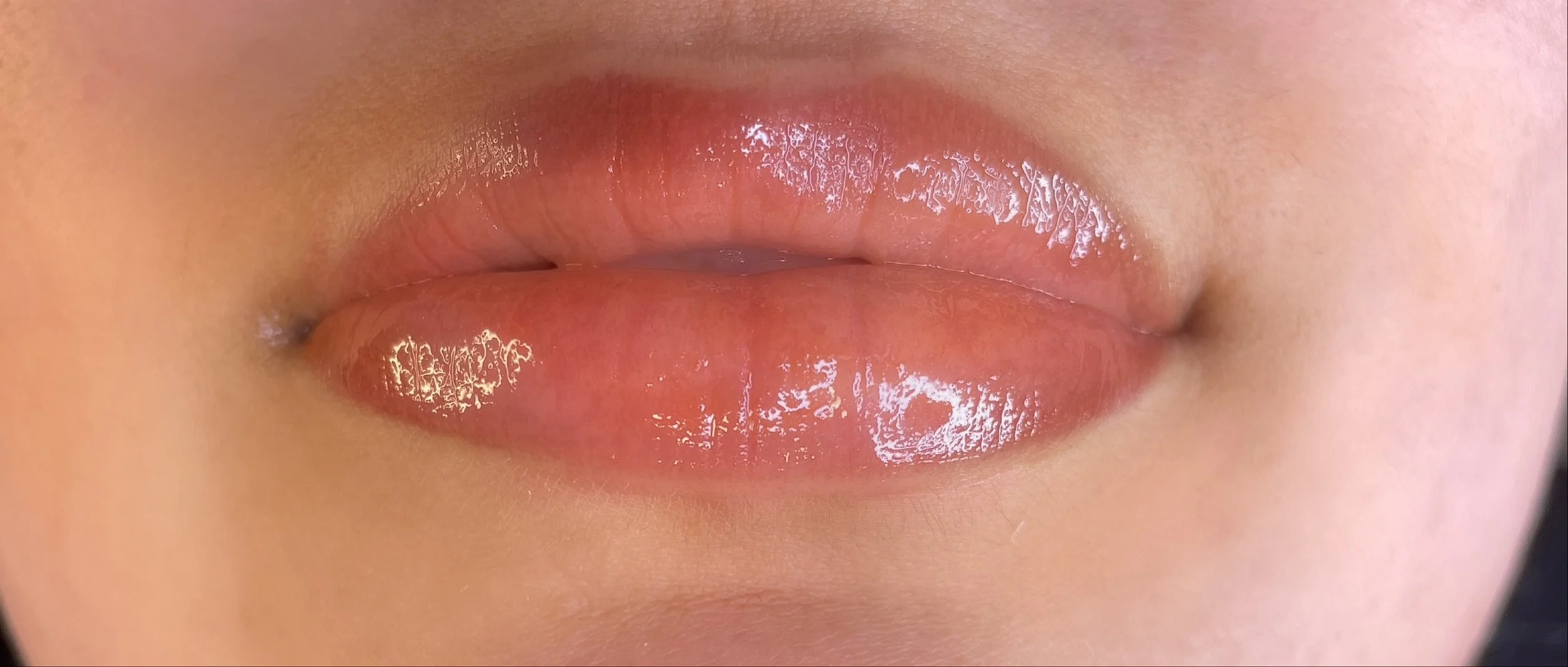 P's neutralization 2.jpeg