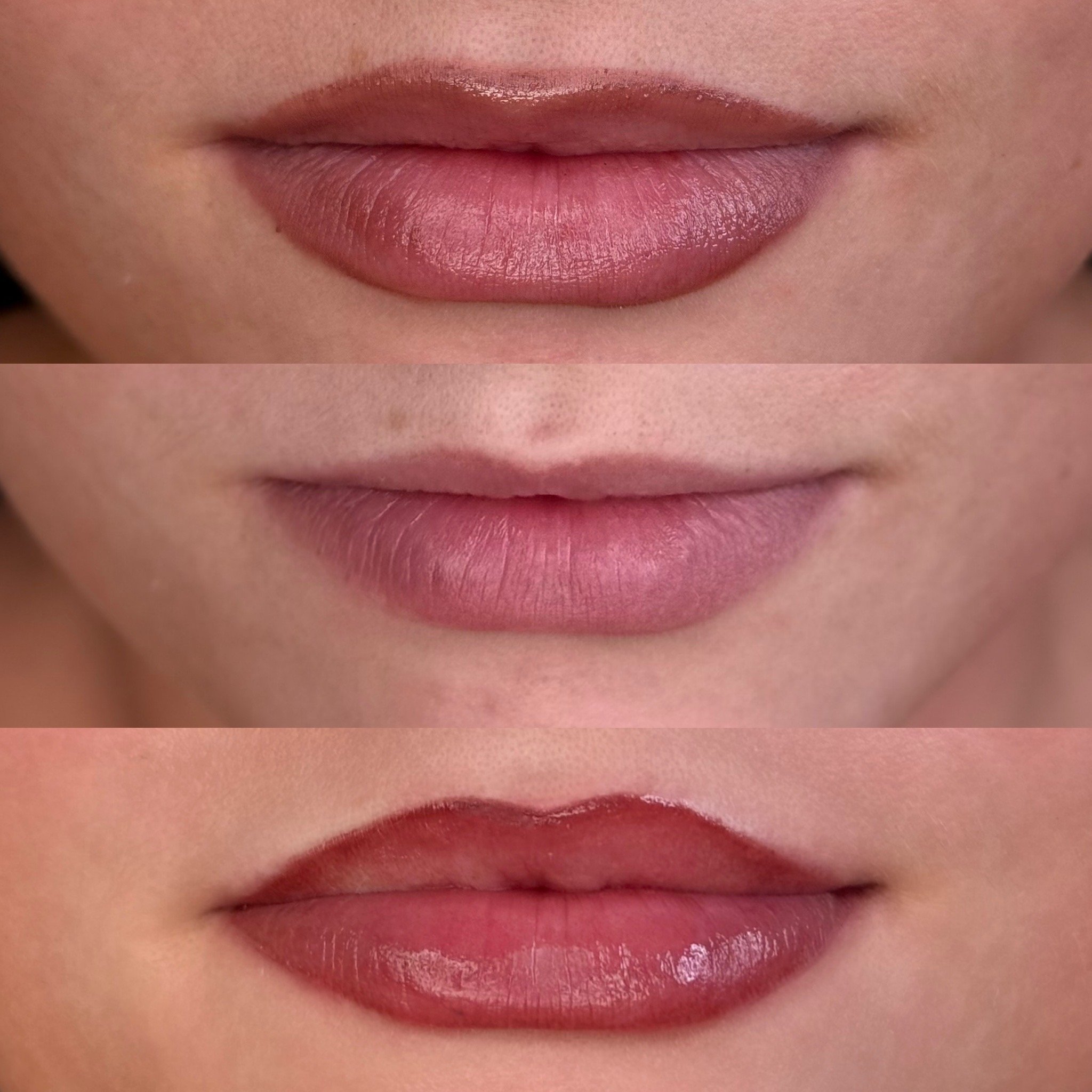 Lips before lip blush treatment