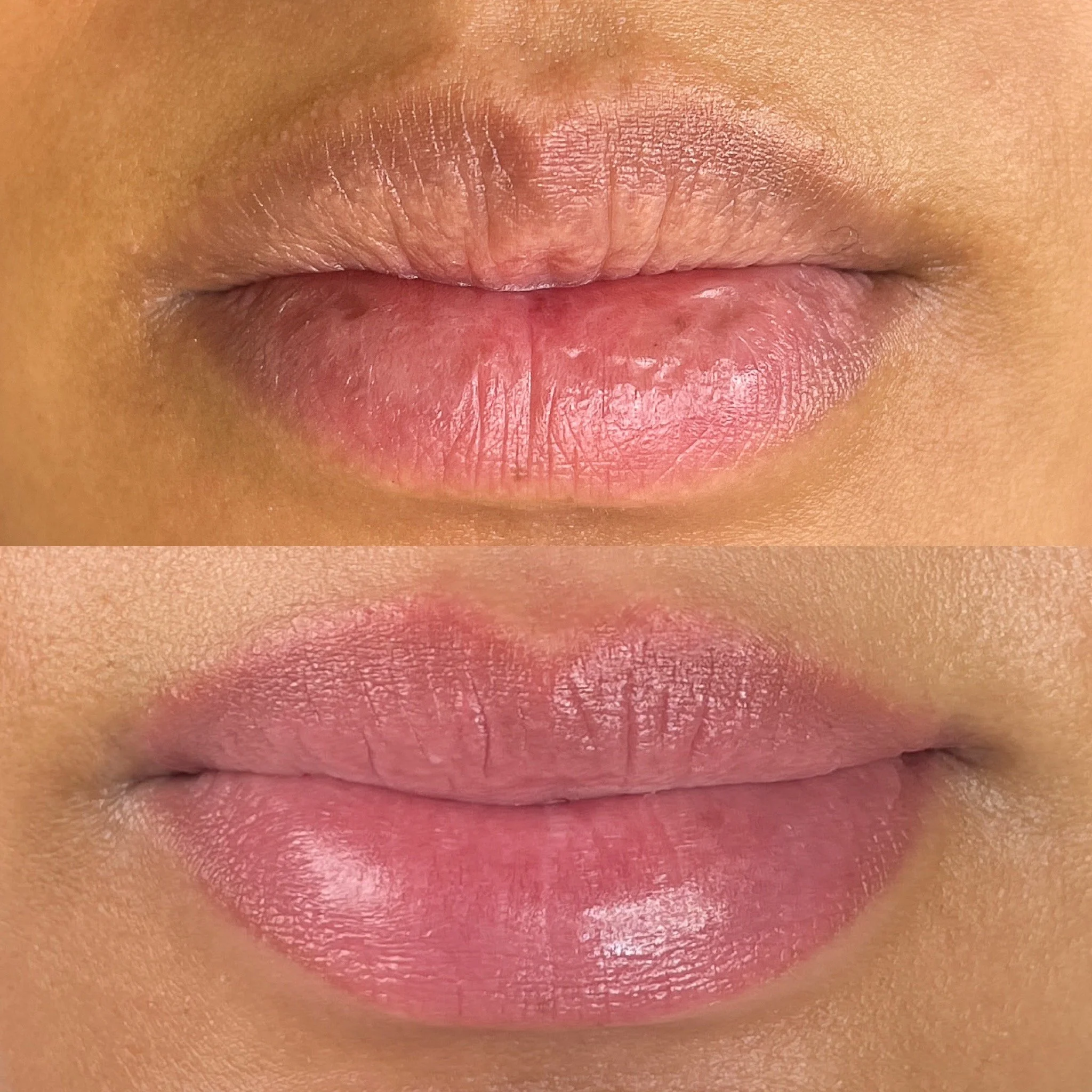 Best Lip Neutralization in Edmonton at Studio Vanassa on Whyte Ave
