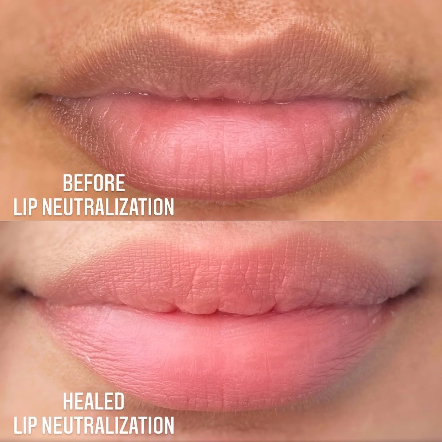 P's neutralization.jpeg