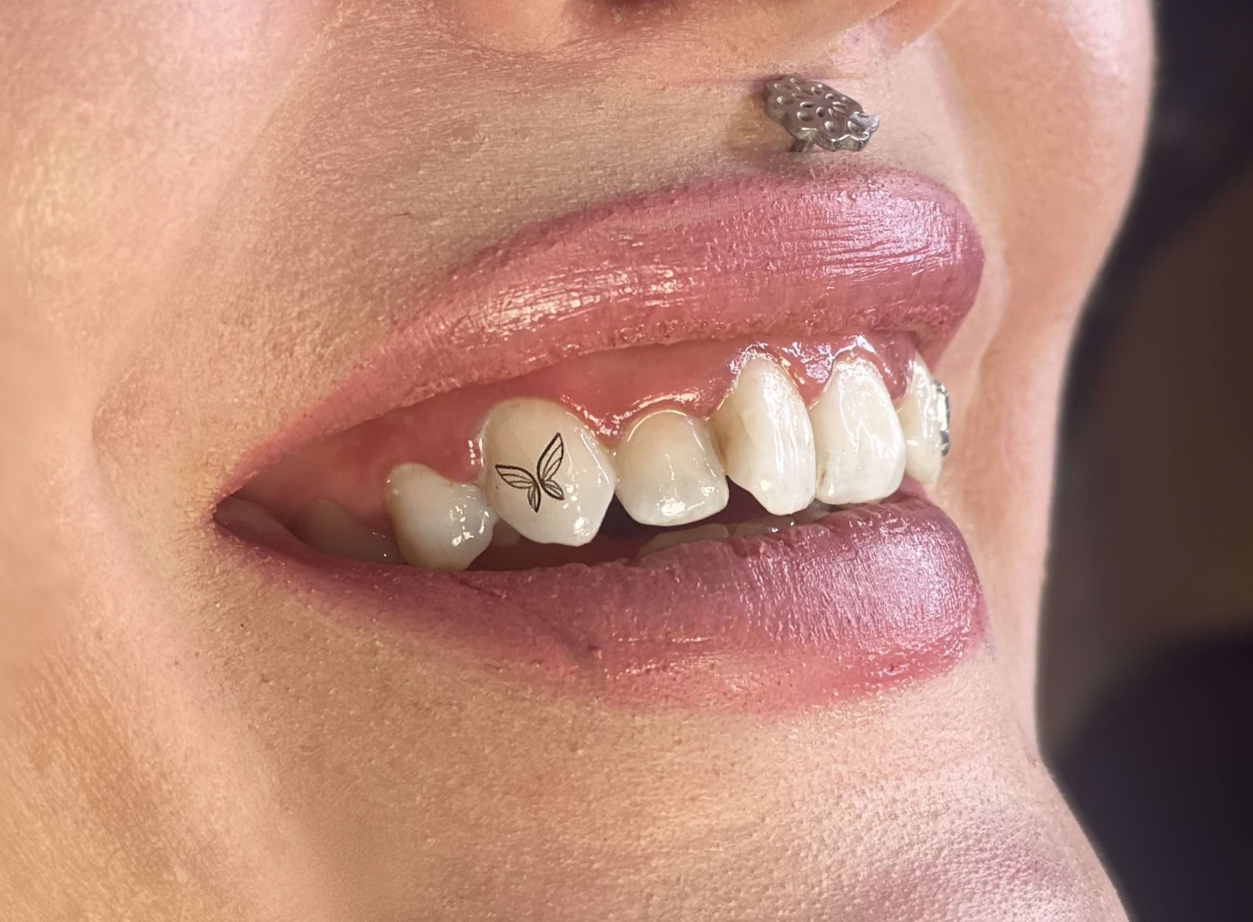 Why Do People Get Teeth Gems? 3 Things You Need To Know