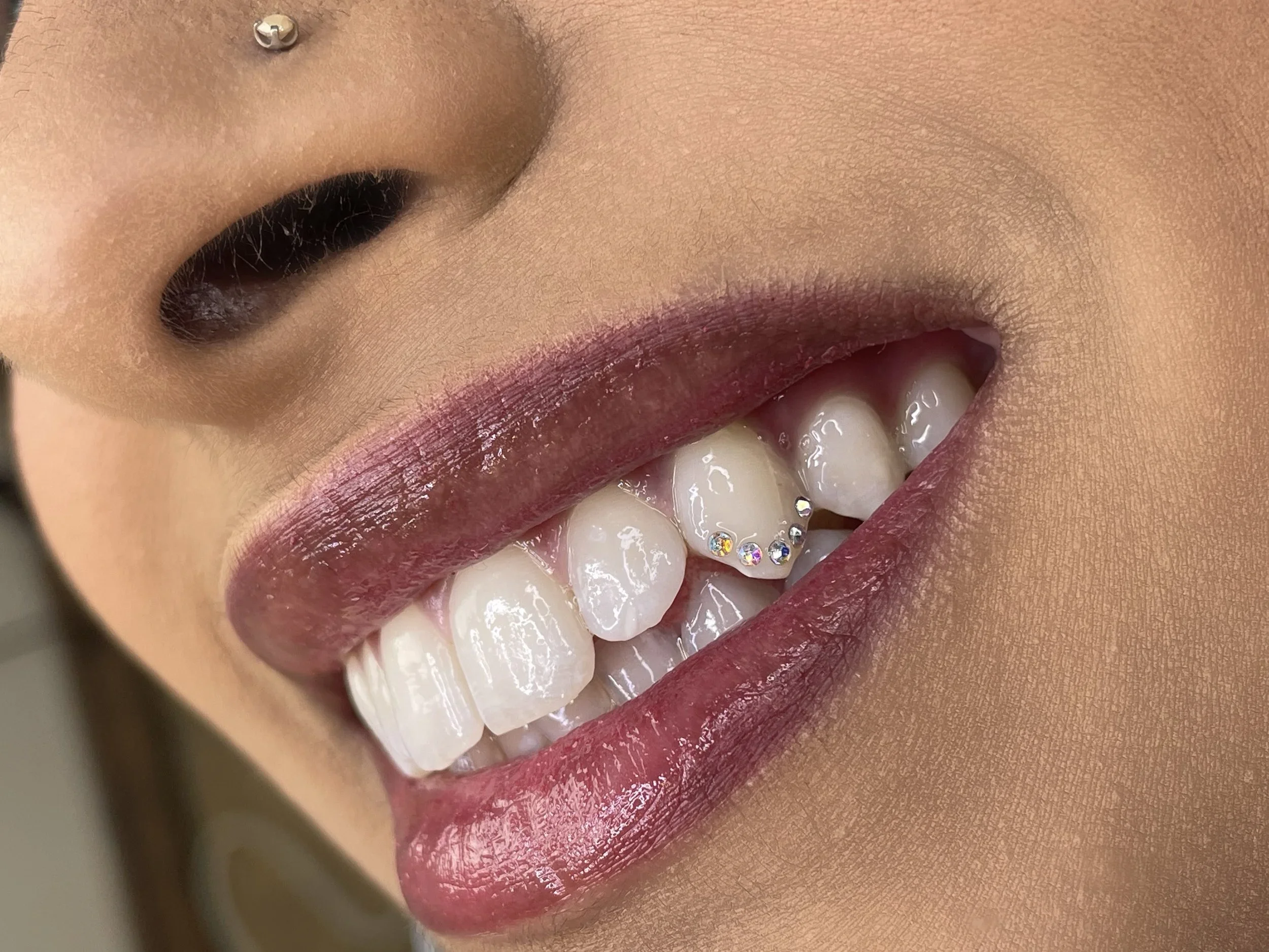 iridescent tooth gems