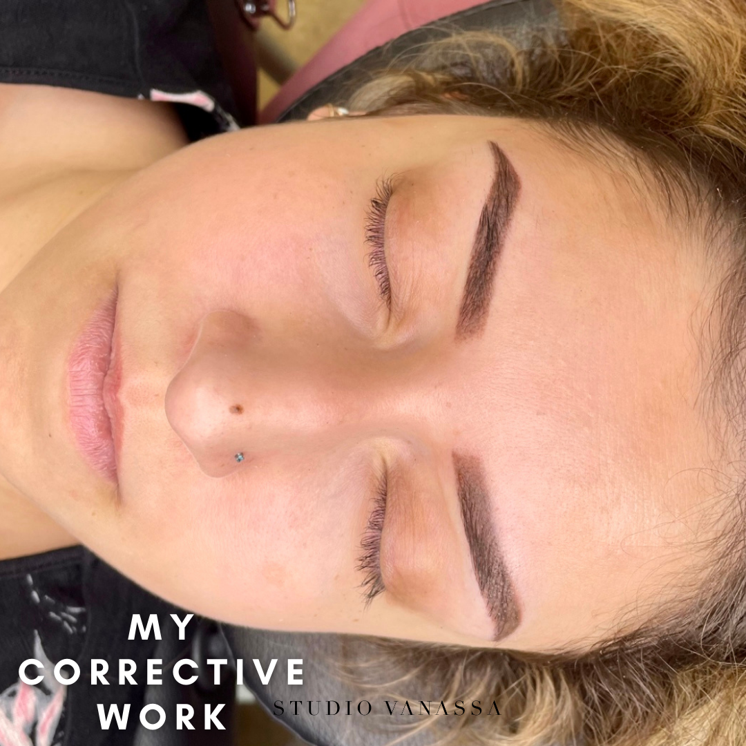 Client's brows after corrective brow procedure