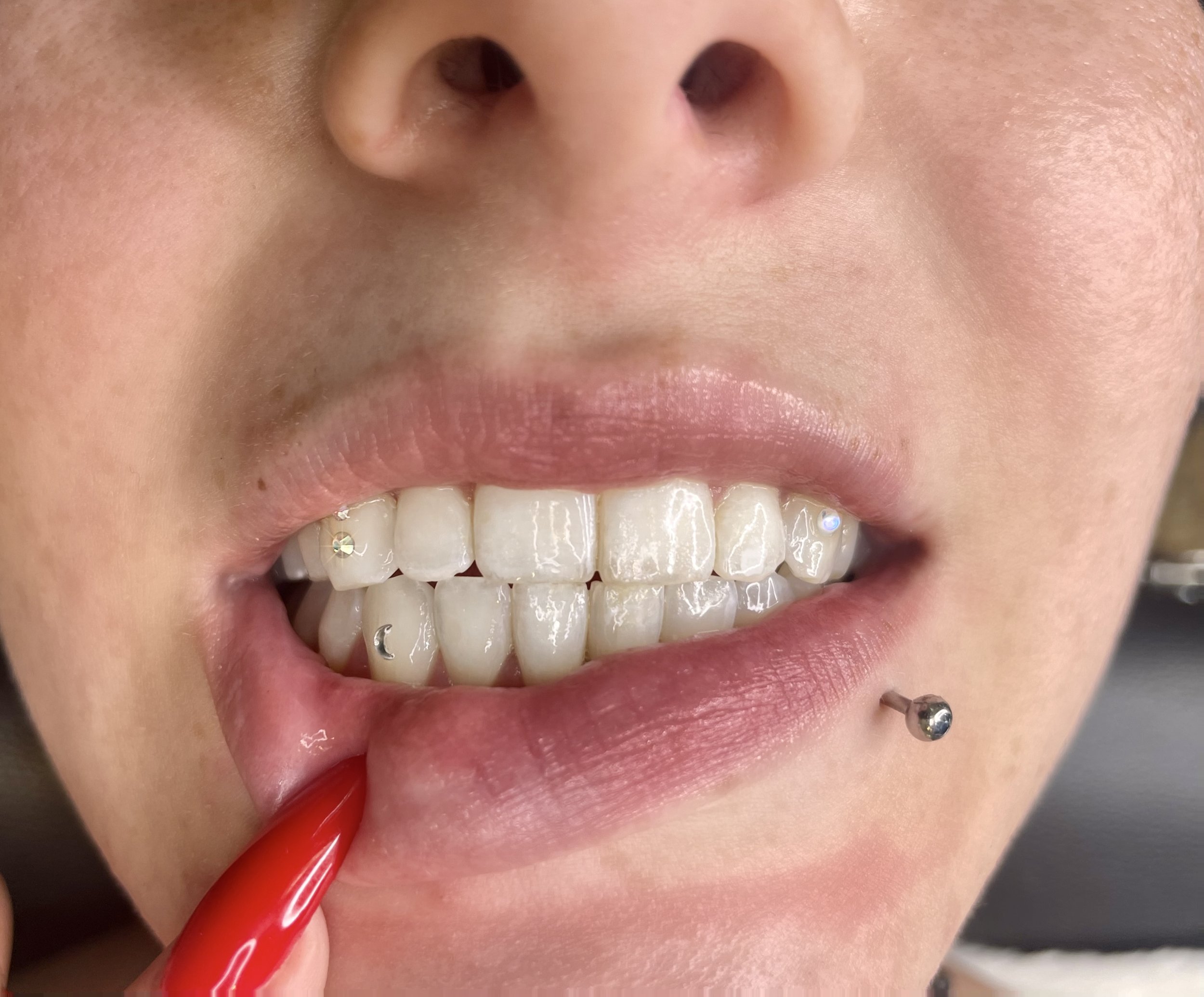 Best Tooth Gems in Edmonton  Studio Vanassa Tooth Gems — STUDIO VANASSA
