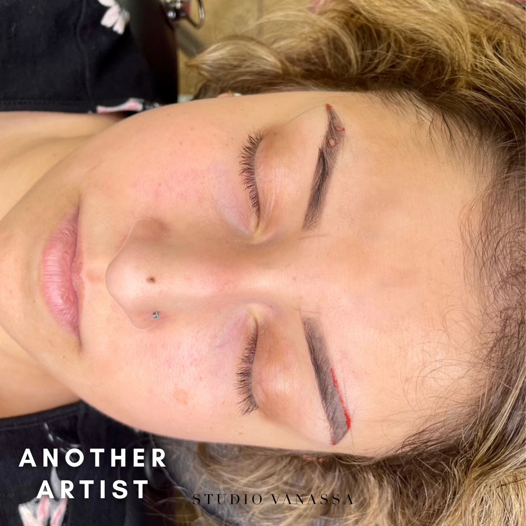 Client's brows before corrective brow procedure