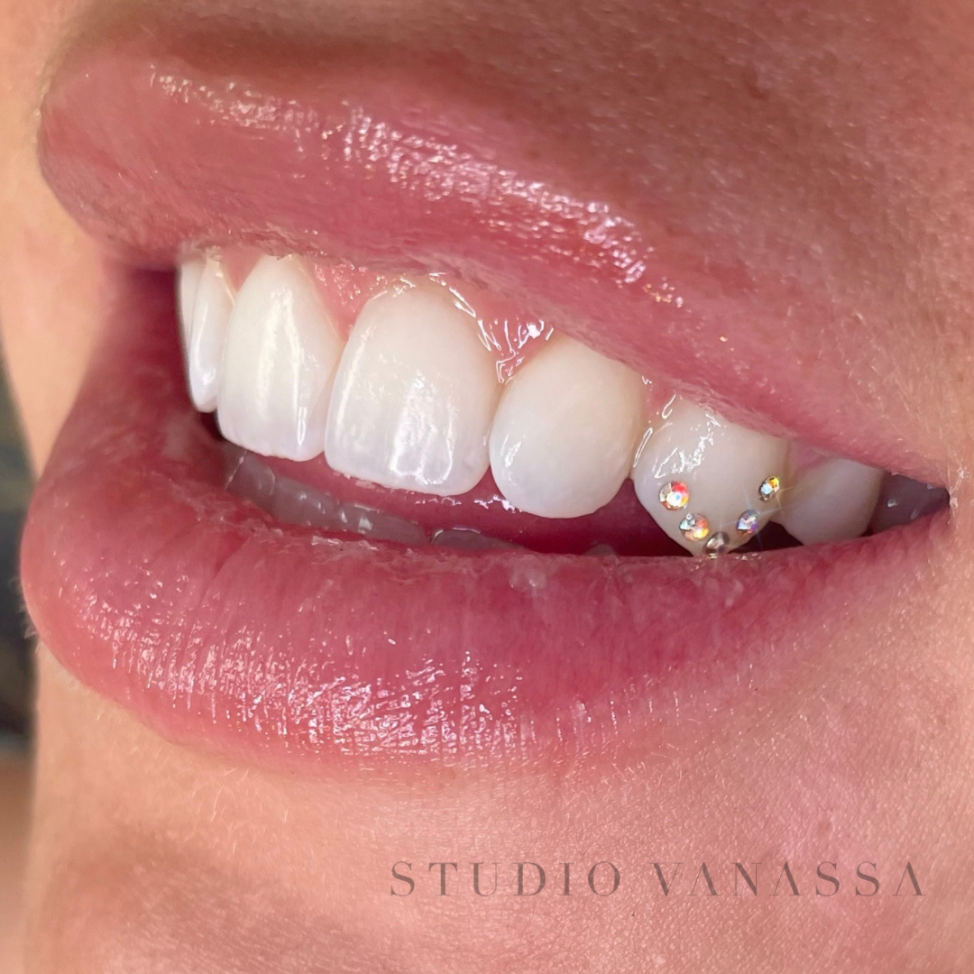 Best Tooth Gems in Edmonton  Studio Vanassa Tooth Gems — STUDIO VANASSA