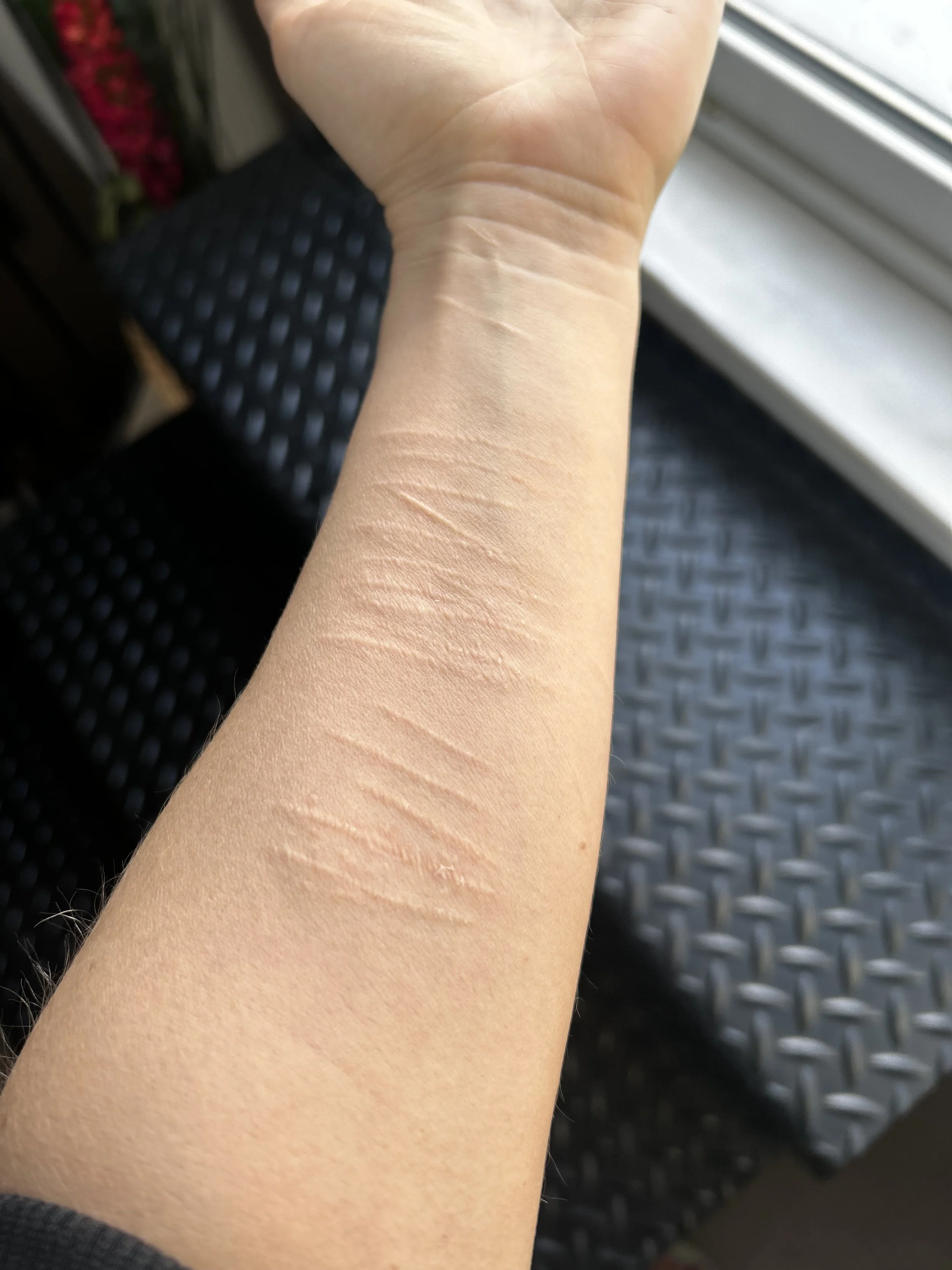 Best Self Harm Camouflage Tattoo in Edmonton, Alberta at Studio Vanassa on Whyte Ave