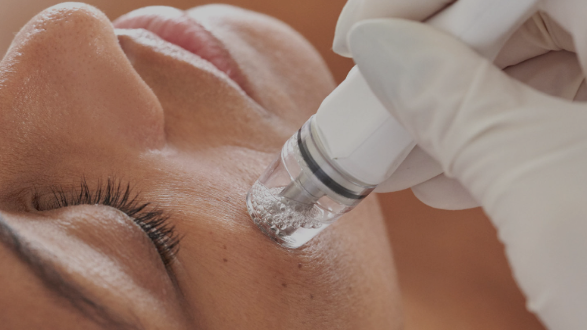 DiamondGlow Facial