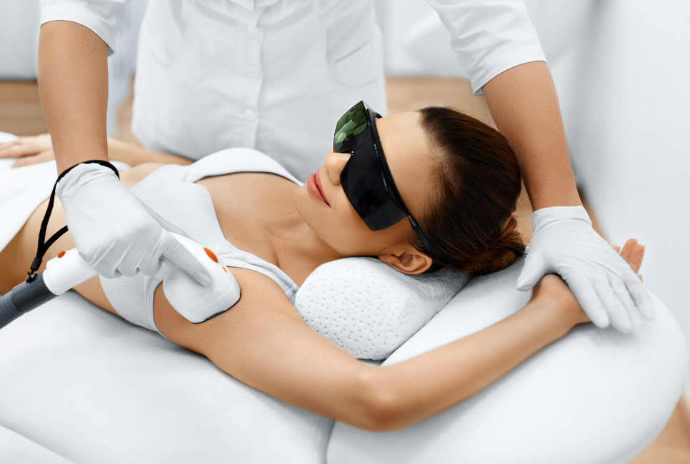 laser underarms