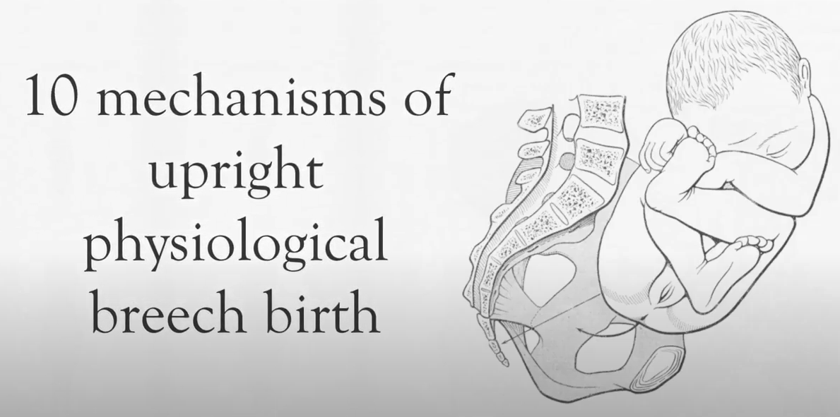 breech birth an overview — Born Strong Doula Services LLC