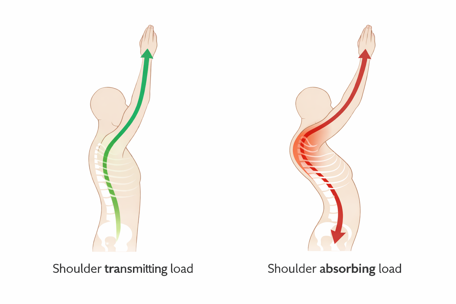 Illustration comparing proper shoulder load transfer through the trunk versus dysfunctional posture causing the shoulder to absorb load during overhead movement.