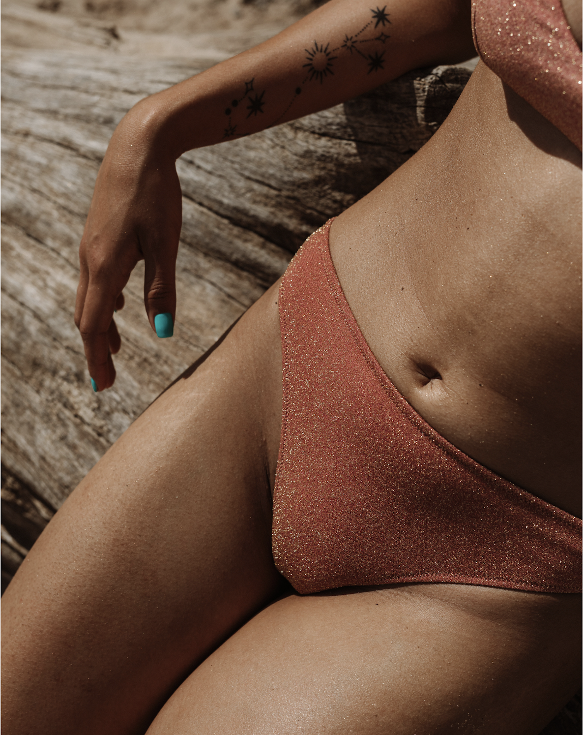 Bikini Hyperpigmentation Treatment