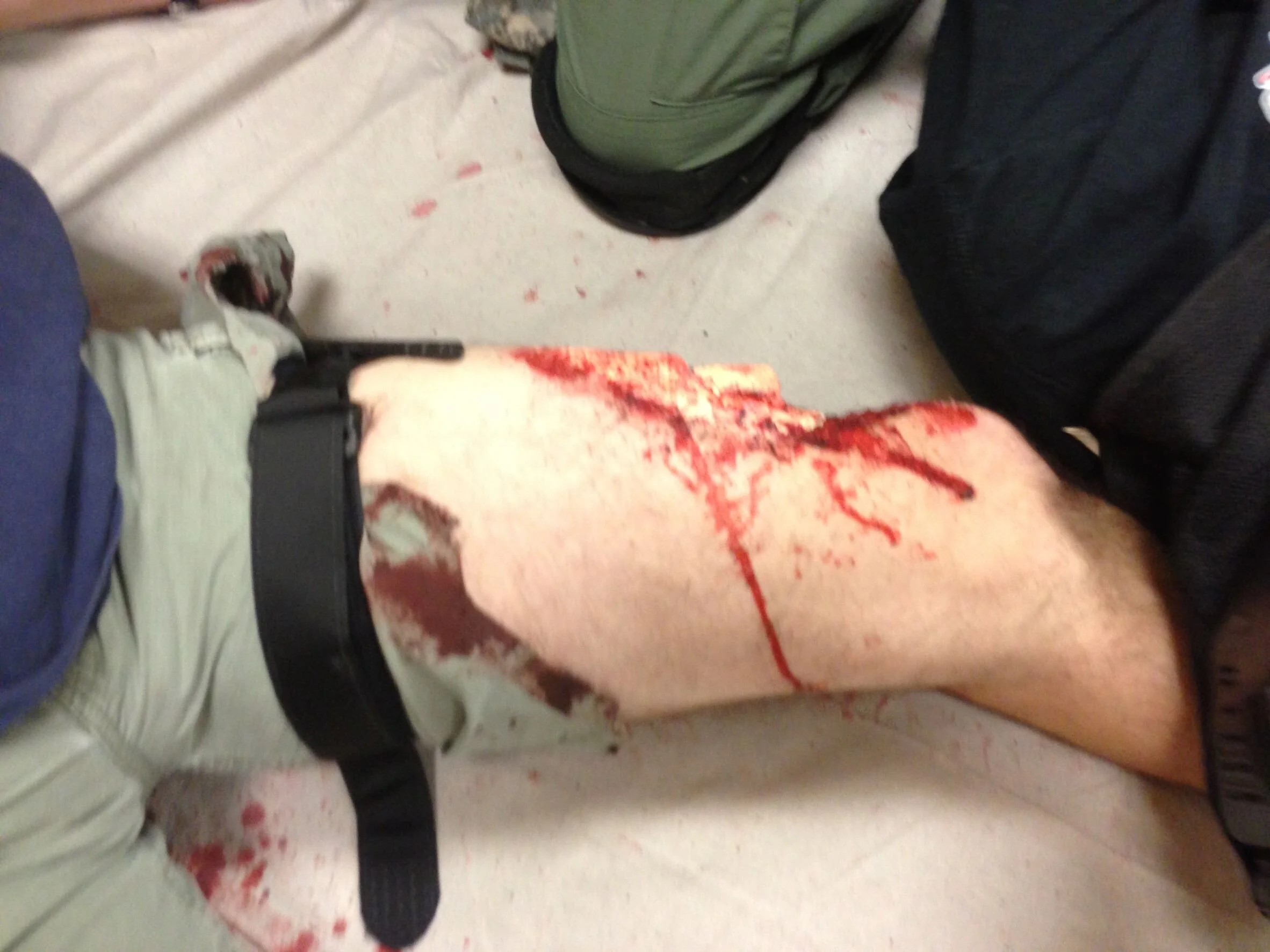 Close up of man's severe moulage leg wound for hands-on training