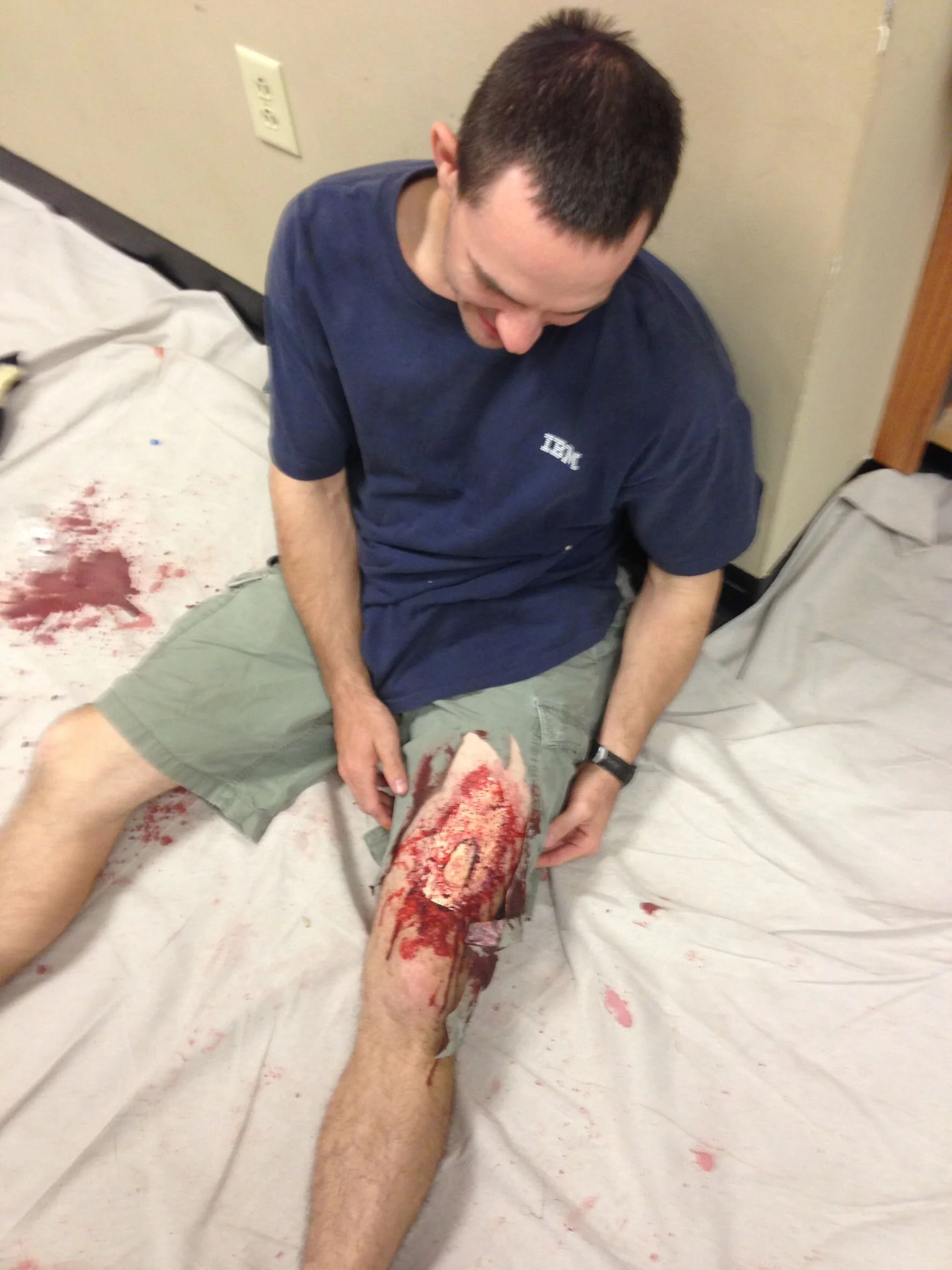 Man playing "victim" with severe moulage leg wound for hands-on training