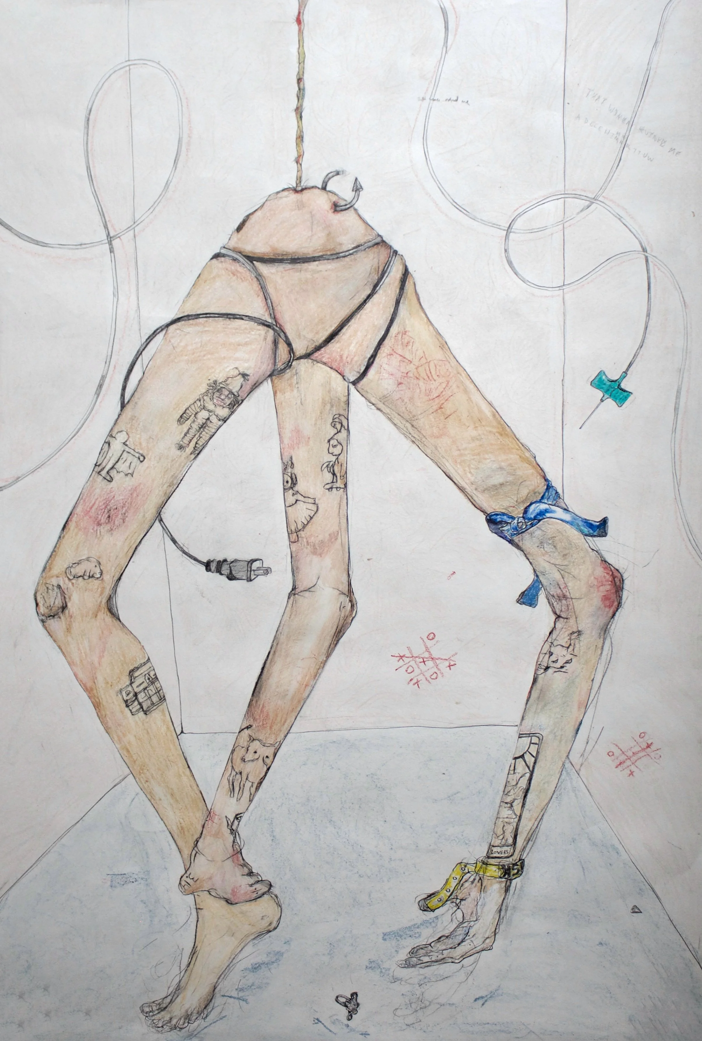 tourniquet application (insertion, removal)