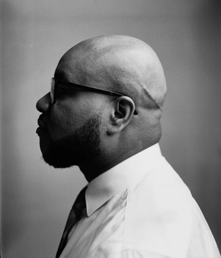 Portrait en noir et blanc d'un homme chauve portant des lunettes épaisses, pris de profil.