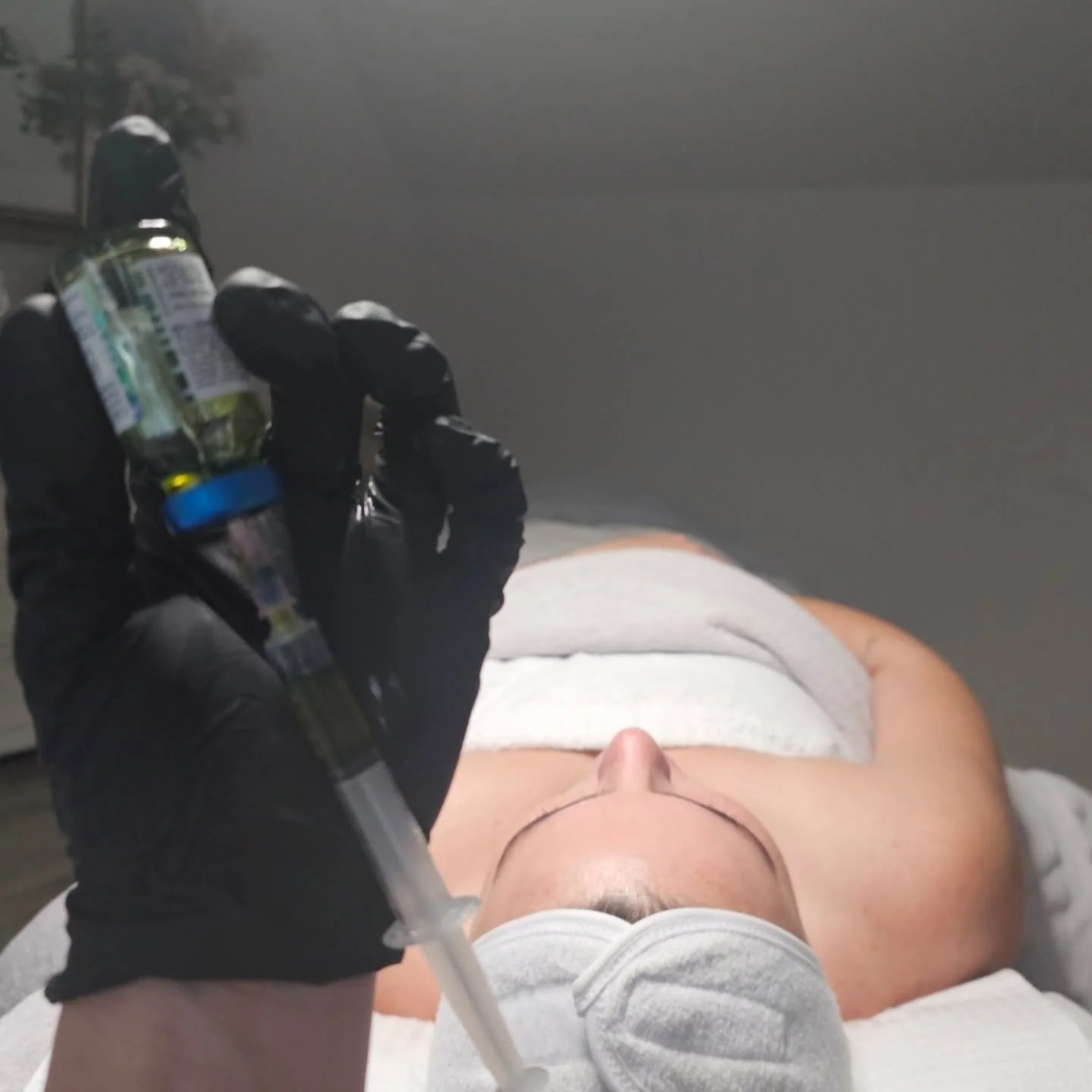 BioRePeel time 💛

This biphasic peel removes dead skin, boosts cell turnover, and refines texture &mdash; all while hydrating and strengthening the skin barrier. 

The result? A brighter, smoother, more even complexion ✨

#BioRePeel #BioRePeelCL3 #S