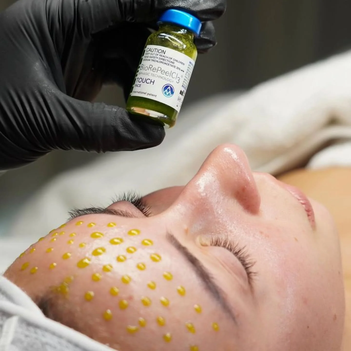 Unlike harsh peels, BioRePeel works with your skin &mdash; not against it 
Its biphasic formula protects the skin barrier while renewing the surface.

🟡 Oil phase = nourishes + prevents water loss
🔵 Active phase = exfoliates + brightens gently

Res