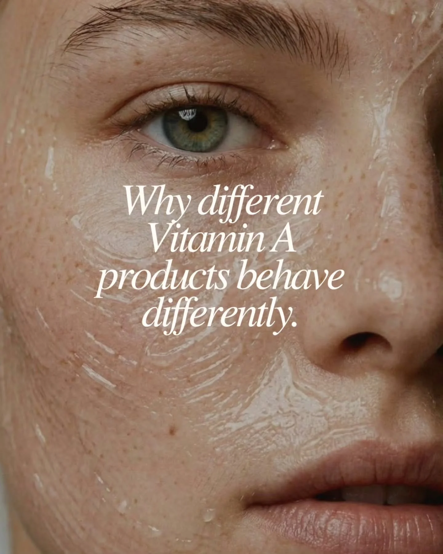 Vitamin A is my NO1 FAVOURITE ingredient of ALL time.
Anytime im looking at a range- im straight to what their A is like.

I know that's a big call, its capable of SO many things, because of how it works.

It communicates with skin cells and influenc