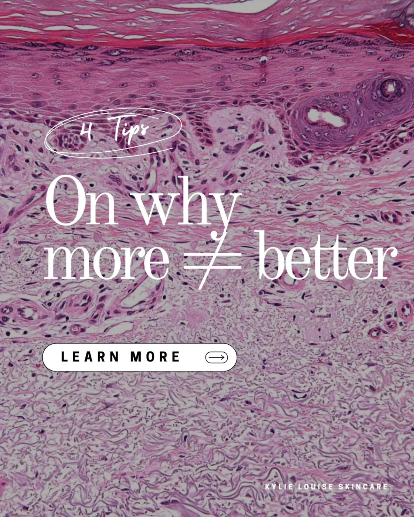 Intentional, thought out actives in a homecare plan, combined with a strategic in clinic treatment plan will win.. every 👏 single 👏 time.

Its not MORE. It's PATIENCE 

The skin has biological limits, or we would all be Benjamin Button-ing it and a