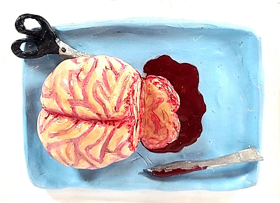 Brain Surgery 006.jpeg
