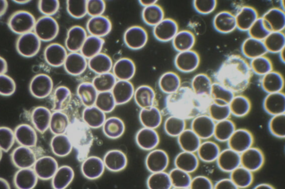 Microscopic view of numerous small, round cells or particles, some glowing or bright, scattered across a dark background.