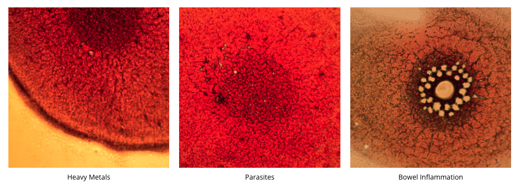 Three microscopic images showing: heavy metals, parasites, and bowel inflammation, each labeled accordingly.