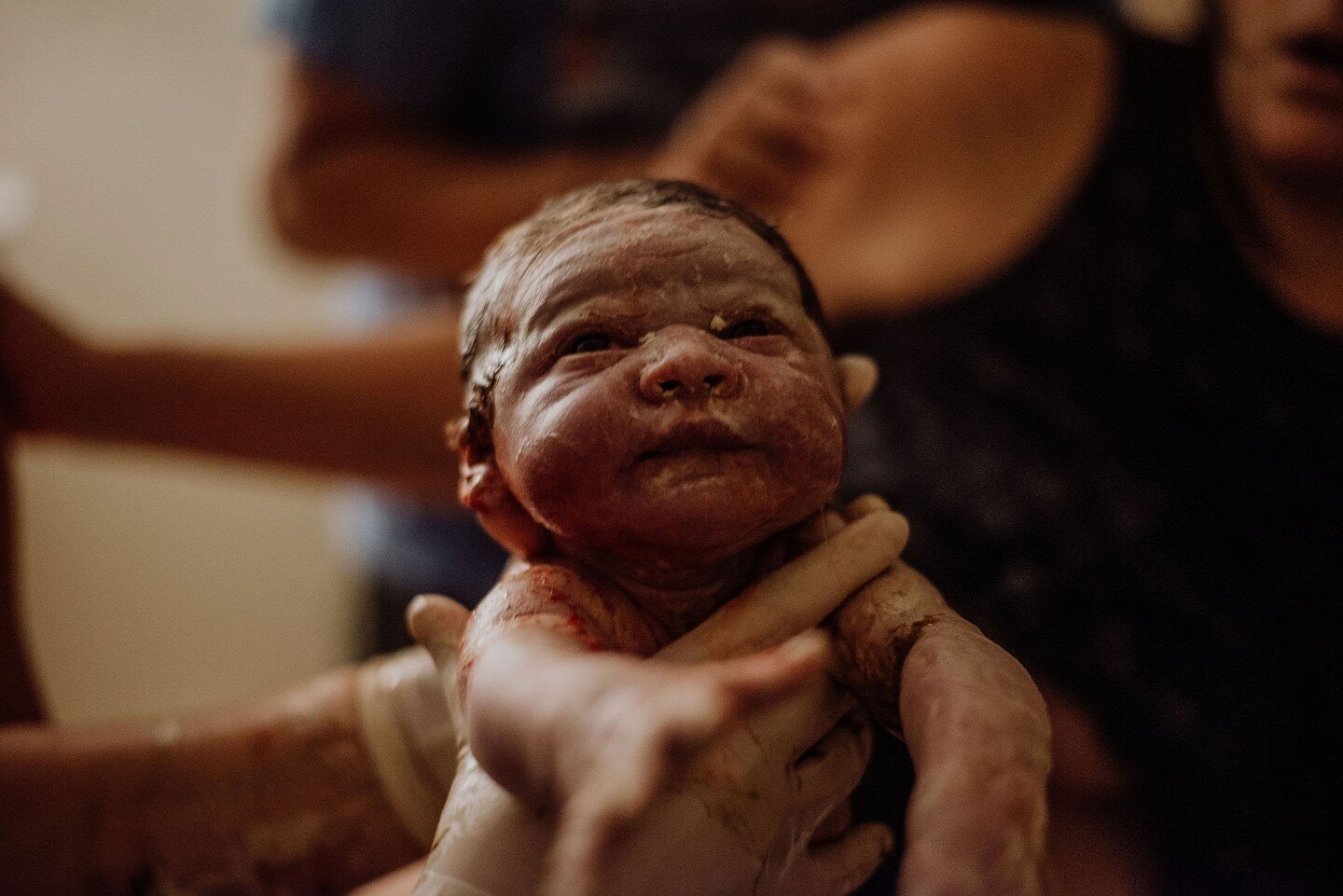 Have you ever wondered what the white chunky, cheesy looking stuff is that some newborn babies are born with?

It's vernix caseosa.  Also known as birth frosting! 

Vernix = to varnish 
Caseosa = of cheesy nature

Vernix is a natural film that develo