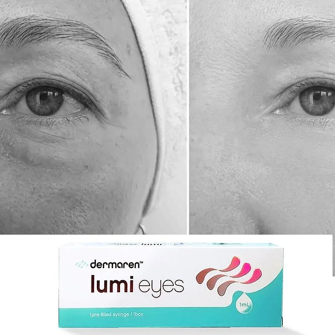 LUMI Eyes — Tyrone House Dental
