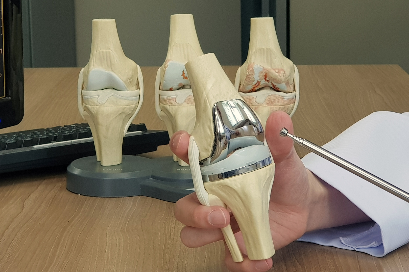 Model of a knee joint with a metallic prosthesis, held in a person's hand, with additional knee joint models in the background.