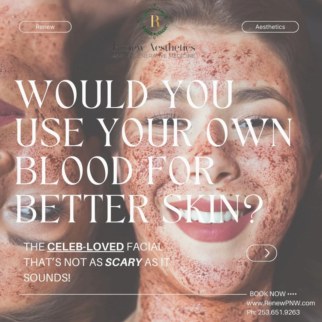 🧛‍♀️✨ also known as the "Vampire" Facial: Not as Scary as it Sounds! ✨🩸
Okay, let’s clear this up — despite the spooky name, the trademarked name "Vampire" Facial (PRP Microneedling) is all glow, no gore. 💉 Her