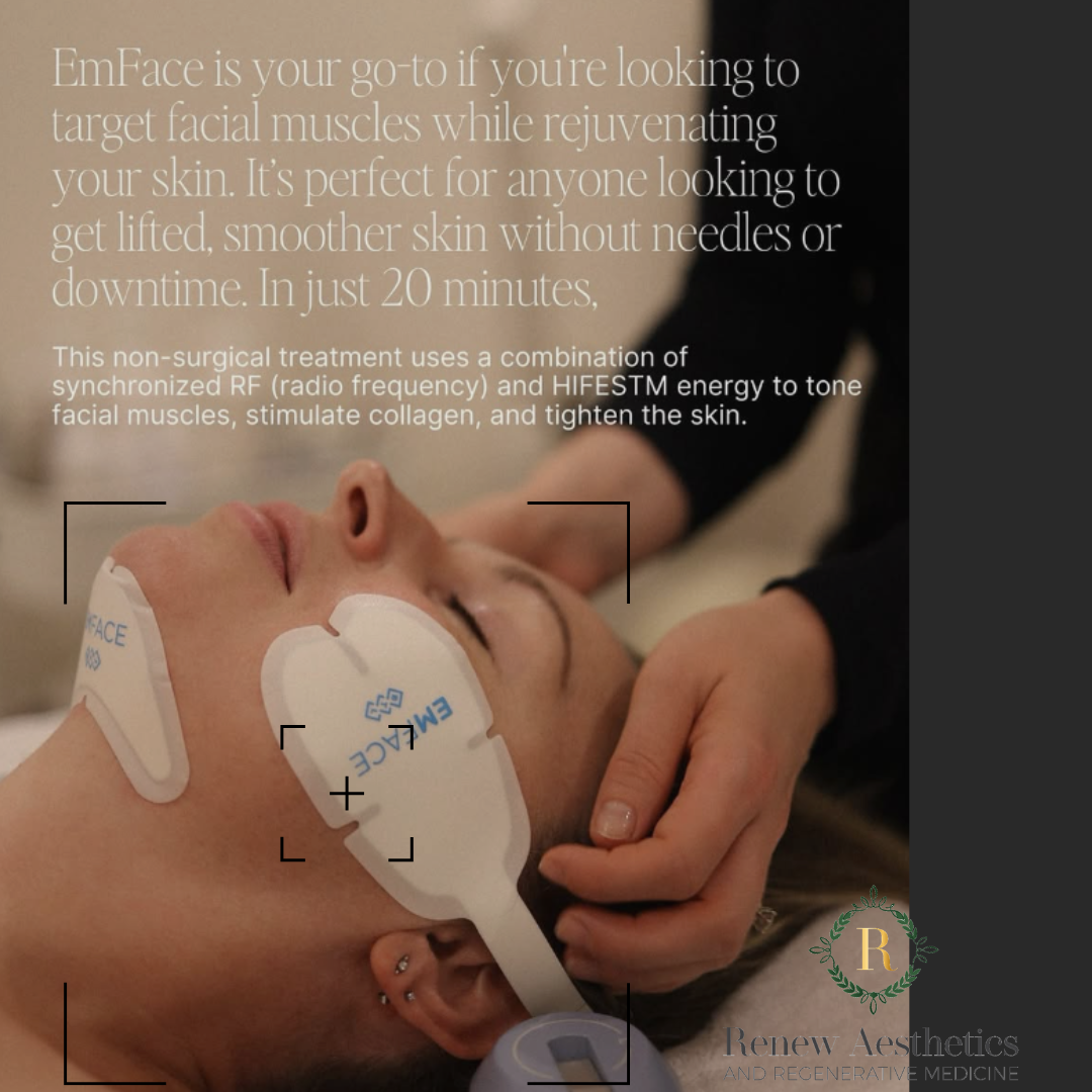 emface nonsurgical face lift facelift
