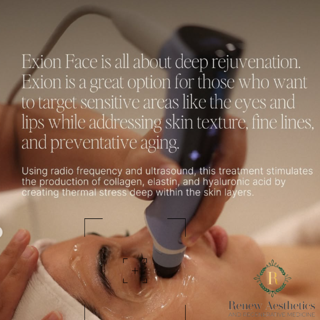 exion face skin rejuvenation hyaluronic acid wrinkle reduction puyallup tacoma seattle