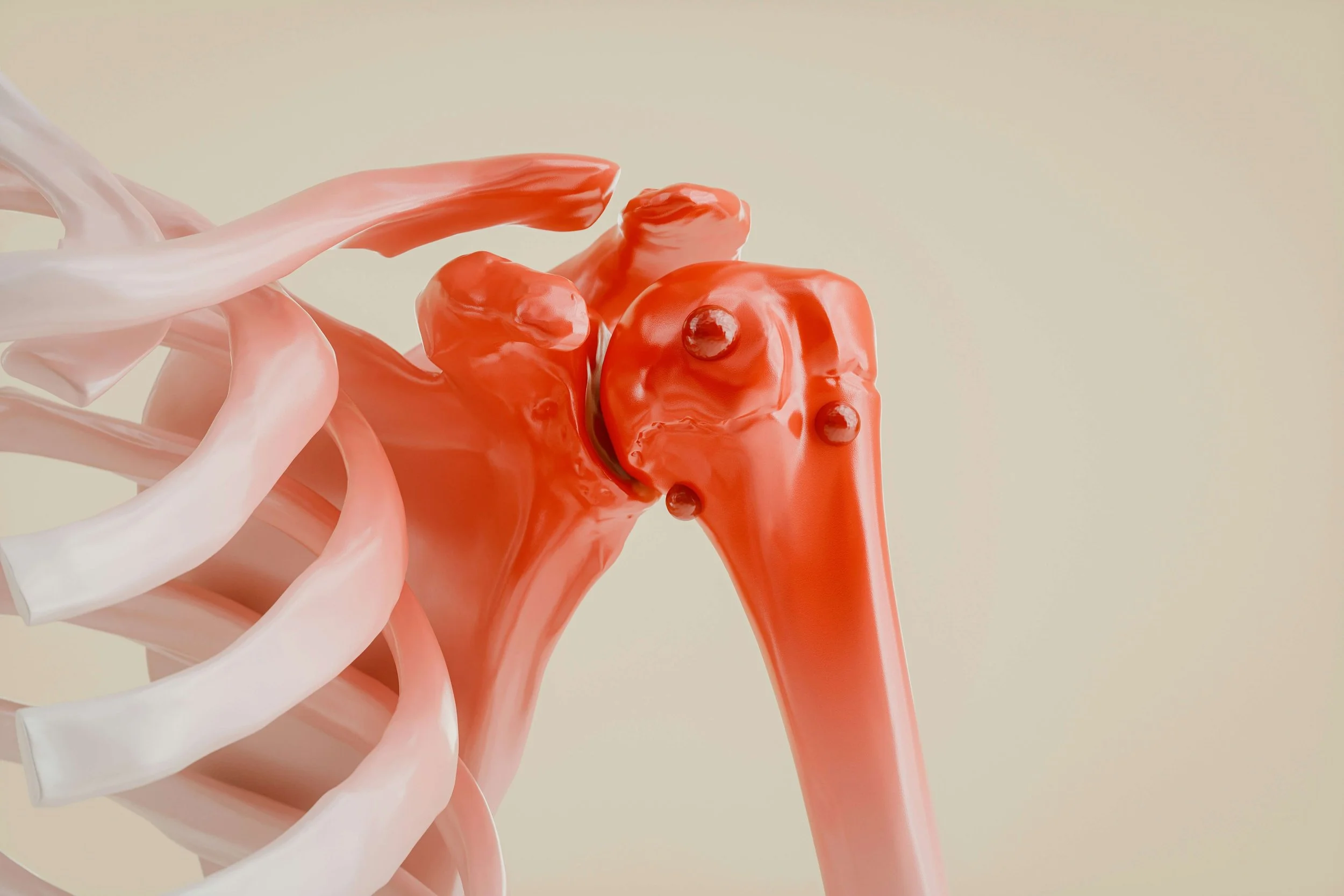 Rotator Cuff-Related Shoulder pain