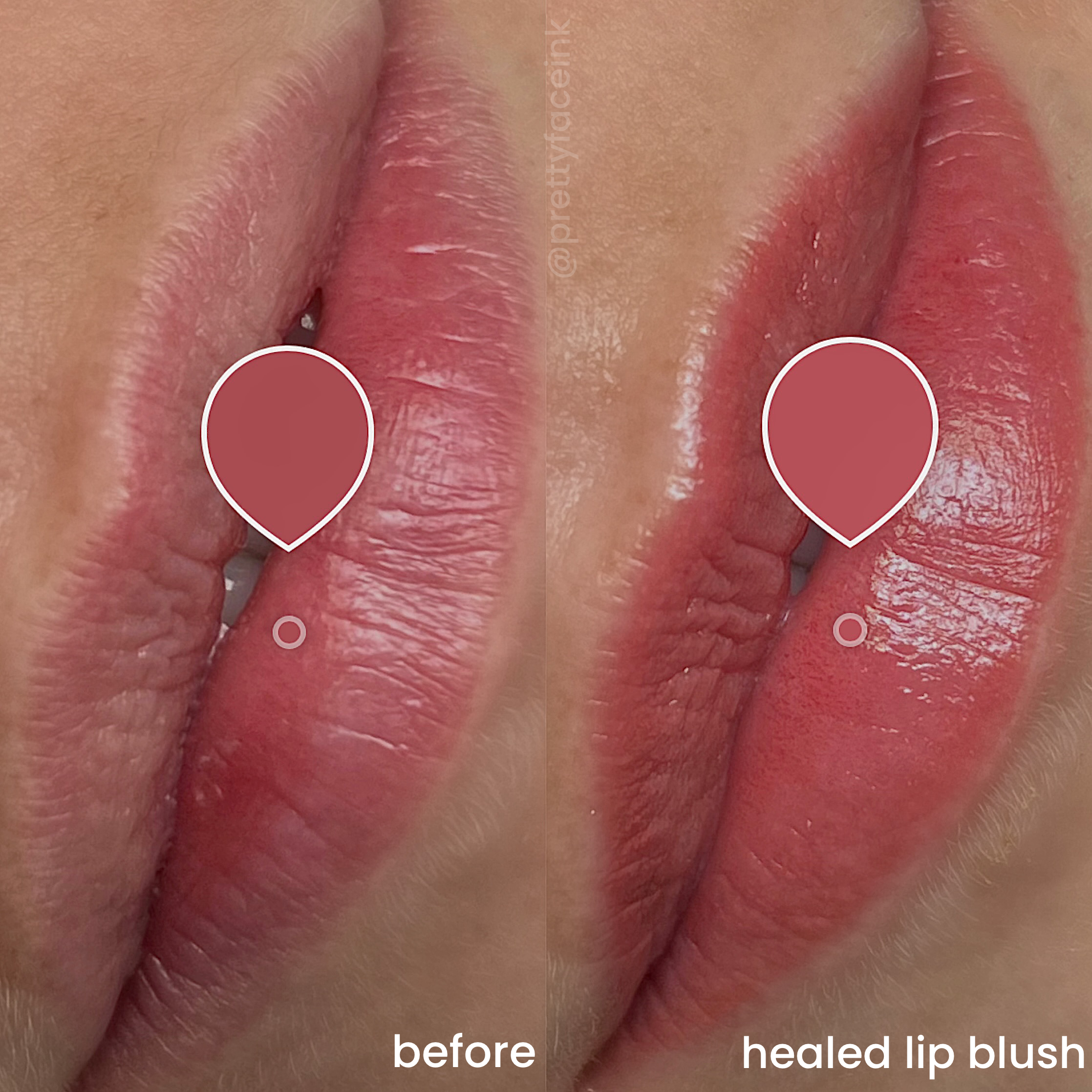 healed lip blush adelaide.PNG