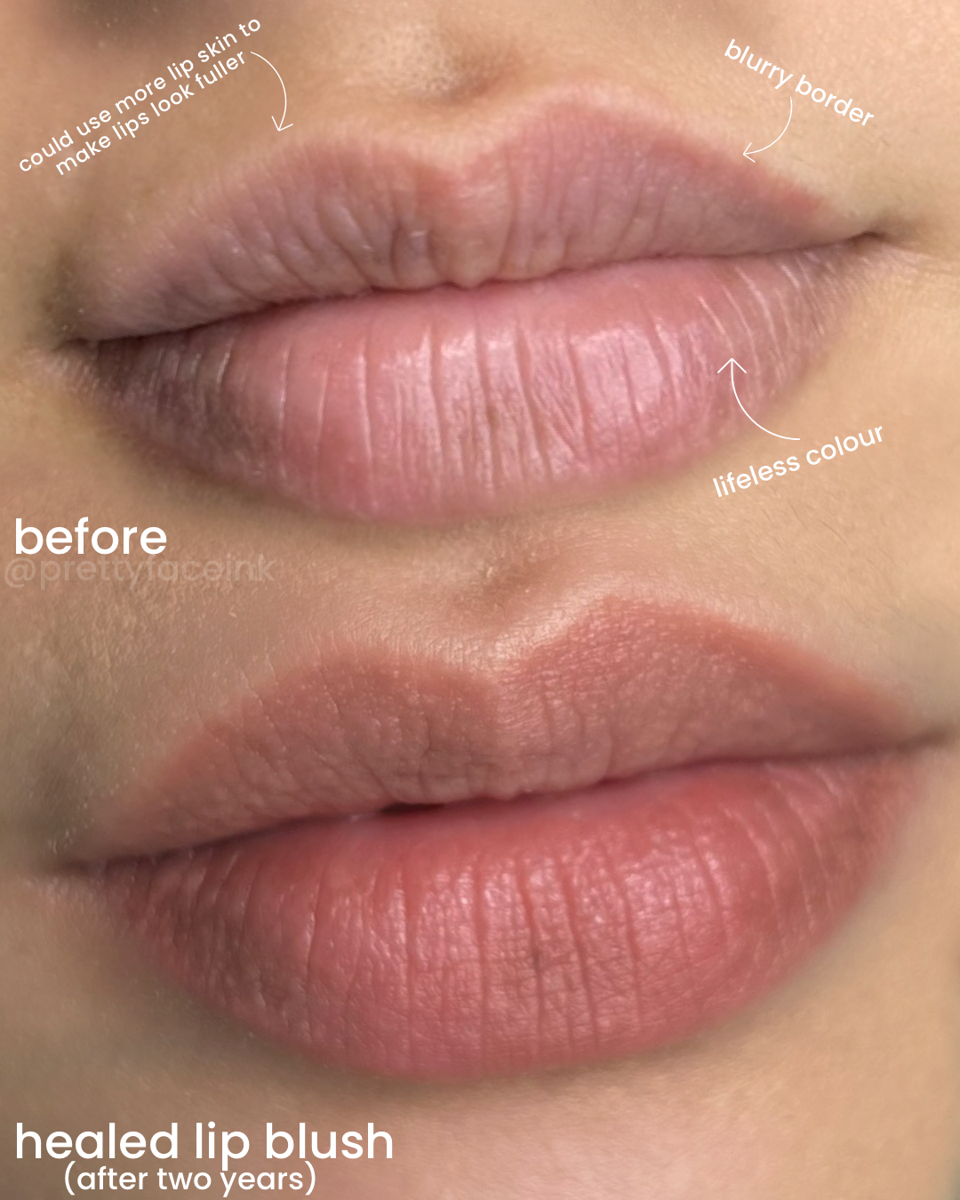 healed lip blush lip stick .PNG