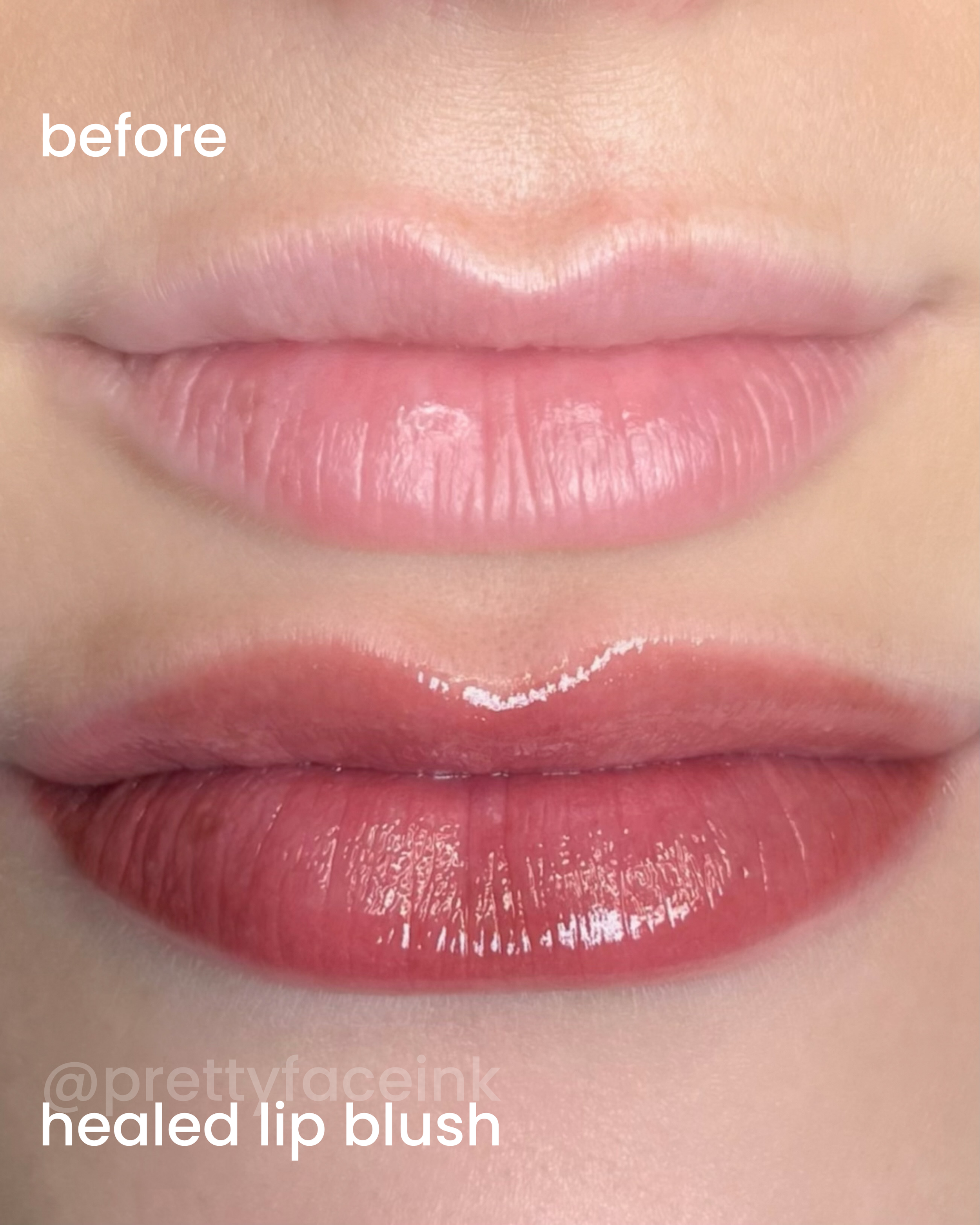 lip blush healed gloss adelaide.PNG