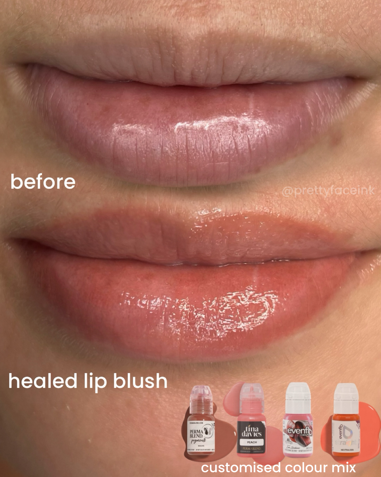 healed lip blush brighten dark lip neutralisation.PNG