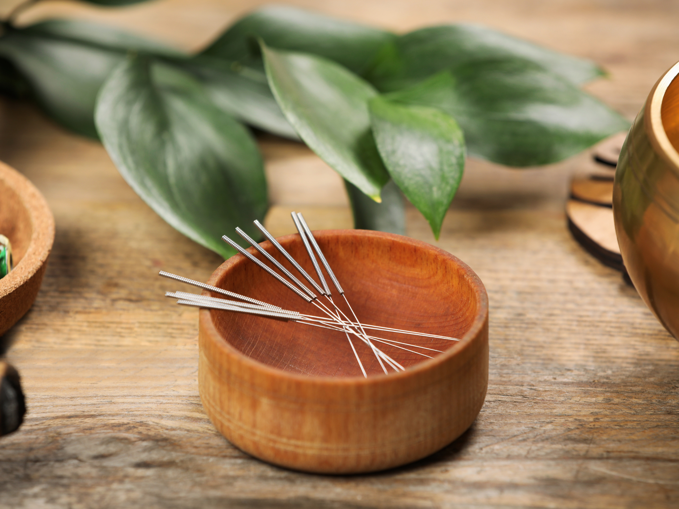 Acupuncture for Sciatica &amp; Piriformis Syndrome: Natural Relief for Nerve and Muscle Pain