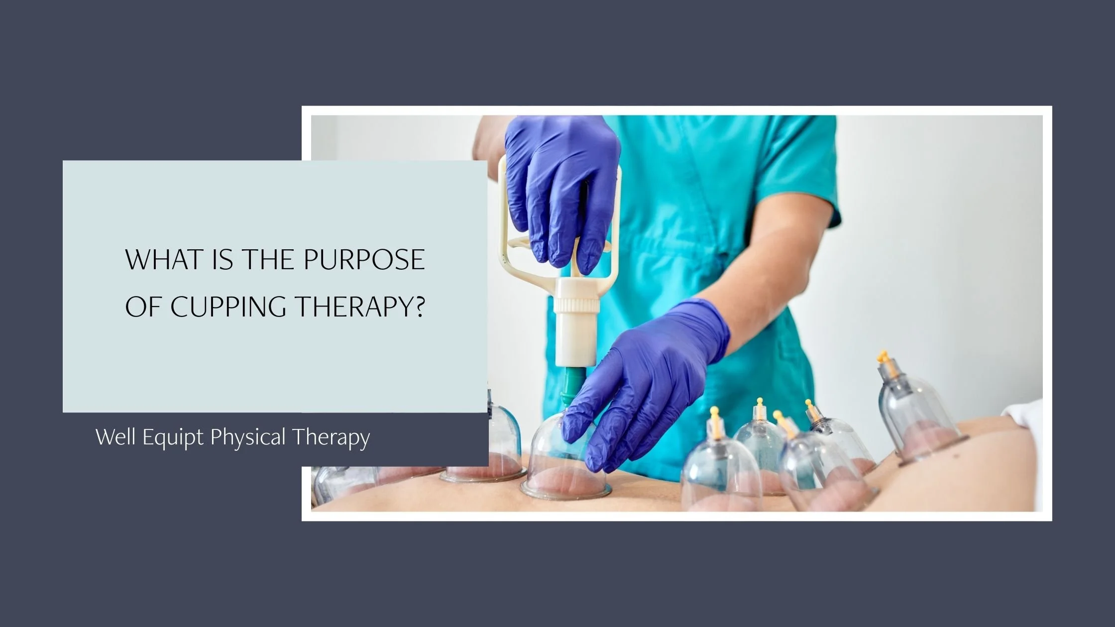 What Is The Purpose of Cupping Therapy?