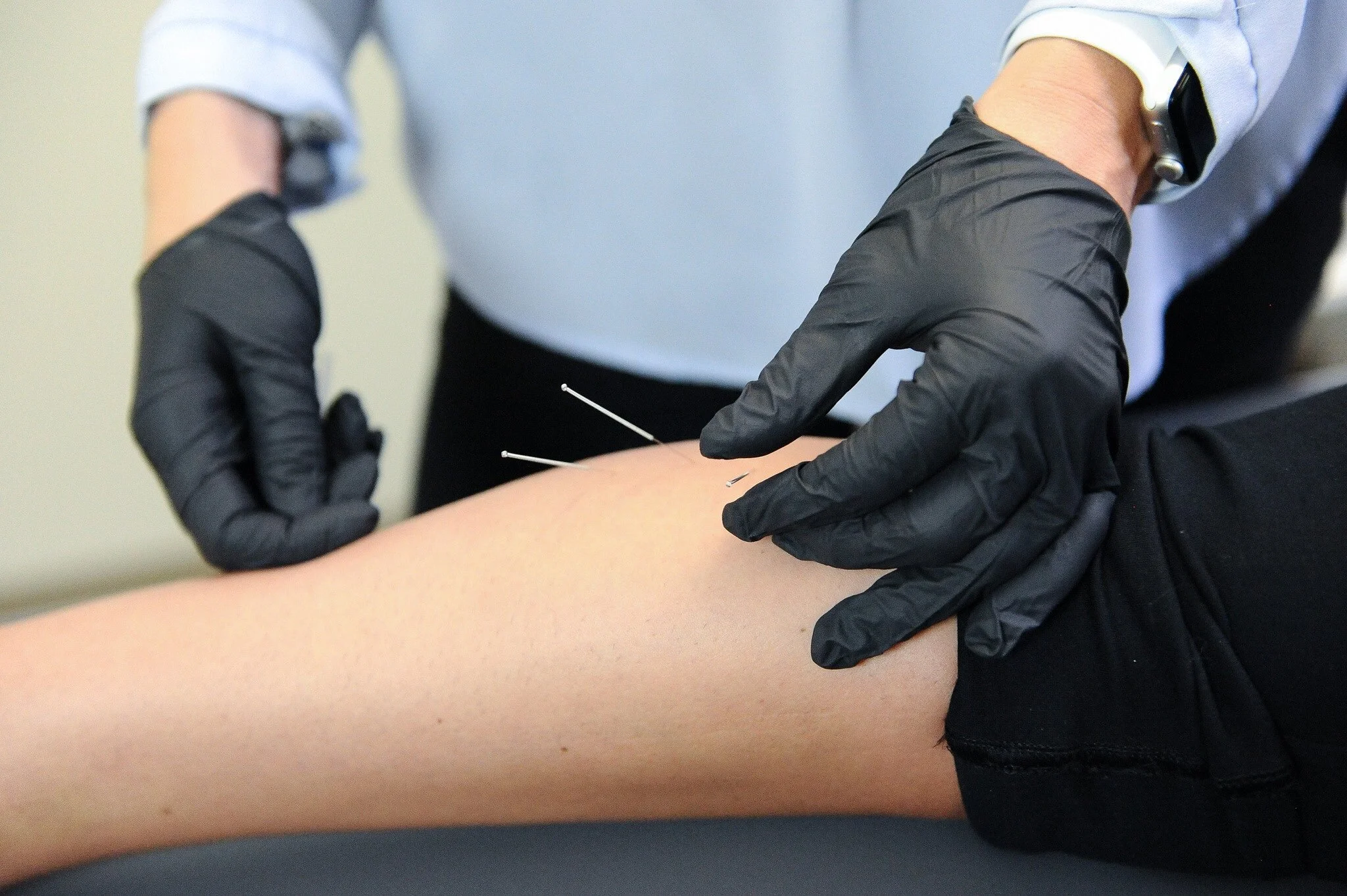 Doctor of physical therapy performing dry needling